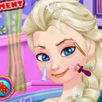 Ice Queen Acne Treatment game screenshot